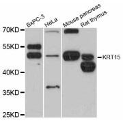 Western blot analysis of extracts of various cell lines, using KRT15 antibody (abx126070) at 1:3000 dilution.