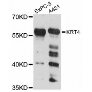 Western blot analysis of extracts of various cell lines, using KRT4 antibody (abx126072) at 1:3000 dilution.