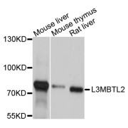 Western blot analysis of extracts of various cell lines, using L3MBTL2 antibody (abx126073) at 1/1000 dilution.