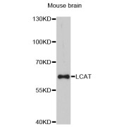 Western blot analysis of extracts of mouse brain, using LCAT antibody (abx126083) at 1:3000 dilution.