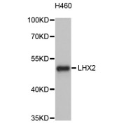 Western blot analysis of extracts of H460 cells, using LHX2 antibody (abx126095) at 1/1000 dilution.