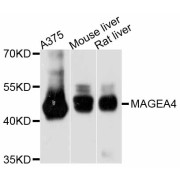 Western blot analysis of extracts of various cell lines, using MAGEA4 antibody (abx126110) at 1:3000 dilution.