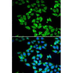 Microtubule-Associated Proteins 1A/1B Light Chain 3B (MAP1LC3B) Antibody