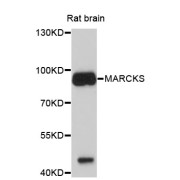 Western blot analysis of extracts of rat brain, using MARCKS antibody (abx126128) at 1/1000 dilution.