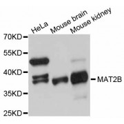 Western blot analysis of extracts of various cell lines, using MAT2B antibody (abx126129) at 1:3000 dilution.