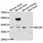 Western blot analysis of extracts of various cell lines, using MC3R antibody (abx126135) at 1:3000 dilution.