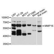 Western blot analysis of extracts of various cell lines, using MMP16 antibody (abx126170) at 1/1000 dilution.