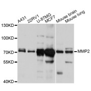 Western blot analysis of extracts of various cell lines, using MMP2 antibody (abx126171) at 1/1000 dilution.