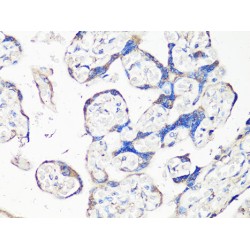 Matrix Metalloproteinase 2 (MMP2) Antibody