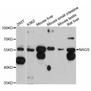 Western blot analysis of extracts of various cell lines, using NAGS antibody (abx126215) at 1:3000 dilution.