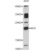 Western blot analysis of extracts of 293T cells, using NTS antibody (abx126282) at 1:3000 dilution.