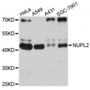 Western blot analysis of extracts of various cell lines, using NUPL2 antibody (abx126287) at 1/1000 dilution.