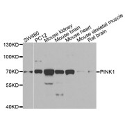 Western blot analysis of extracts of various cell lines, using PINK1 antibody (abx126367) at 1/1000 dilution.