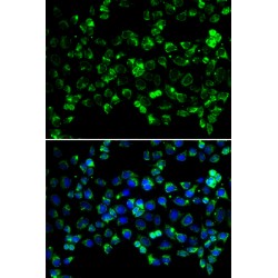 Serine/Threonine-Protein Kinase PINK1, Mitochondrial (PINK1) Antibody