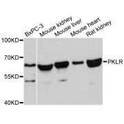 Western blot analysis of extracts of various cell lines, using PKLR antibody (abx126371) at 1:3000 dilution.