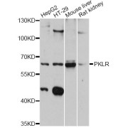 Western blot analysis of extracts of various cell lines, using PKLR antibody (abx126372) at 1:3000 dilution.