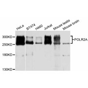 Western blot analysis of extracts of various cell lines, using POLR2A antibody (abx126389) at 1/1000 dilution.