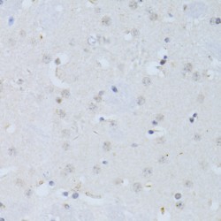 DNA-Directed RNA Polymerase II Subunit RPB1 (POLR2A) Antibody