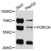 Western blot analysis of extracts of various cell lines, using PORCN antibody (abx126395) at 1:3000 dilution.