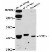 Western blot analysis of extracts of various cell lines, using PORCN antibody (abx126396) at 1:3000 dilution.