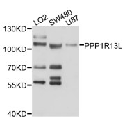 Western blot analysis of extracts of various cell lines, using PPP1R13L antibody (abx126404) at 1/1000 dilution.