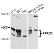 Western blot analysis of extracts of various cell lines, using PPP2R4 Antibody (abx126406) at 1:3000 dilution.