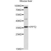 Western blot analysis of extracts of mouse liver, using PPT2 antibody (abx126409) at 1:3000 dilution.