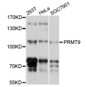 Western blot analysis of extracts of various cell lines, using PRMT9 antibody (abx126419) at 1/1000 dilution.