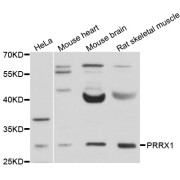 Western blot analysis of extracts of various cell lines, using PRRX1 antibody (abx126420) at 1/1000 dilution.