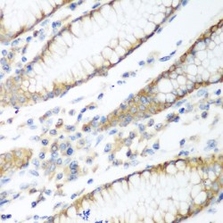 Phosphatidylinositol-3,4,5-Trisphosphate 3-Phosphatase And Dual-Specificity Protein Phosphatase PTEN (PTEN) Antibody