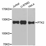 Western blot analysis of extracts of various cell lines, using PTK2 antibody (abx126431) at 1/1000 dilution.