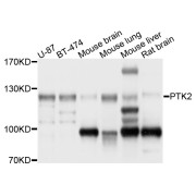 Western blot analysis of extracts of various cell lines, using PTK2 antibody (abx126434) at 1/1000 dilution.