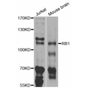 Western blot analysis of extracts of various cell lines, using RB1 antibody (abx126458) at 1/1000 dilution.