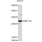 Western blot analysis of extracts of BT-474 cells, using RNF138 antibody (abx126486) at 1/1000 dilution.