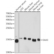 Western blot analysis of extracts of various cell lines, using SAA3 antibody (1/1000 dilution).