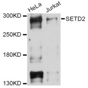 Western blot analysis of extracts of various cell lines, using SETD2 Antibody (abx126537) at 1/1000 dilution.