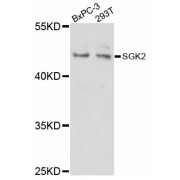 Western blot analysis of extracts of various cell lines, using SGK2 antibody (abx126544) at 1/1000 dilution.