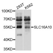 Western blot analysis of extracts of various cell lines, using SLC16A10 antibody (abx126560) at 1/1000 dilution.