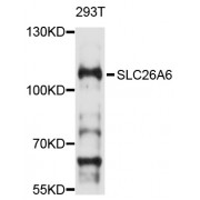 Western blot analysis of extracts of 293T cells, using SLC26A6 antibody (abx126572) at 1/1000 dilution.