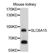 Western blot analysis of extracts of mouse kidney, using SLC6A15 antibody (abx126591) at 1/1000 dilution.