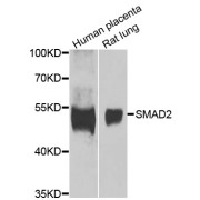 Western blot analysis of extracts of various cell lines, using SMAD2 antibody (abx126596) at 1/1000 dilution.