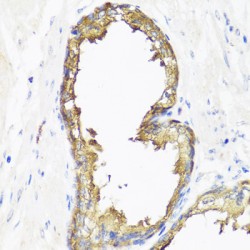 Mothers Against Decapentaplegic Homolog 2 (Smad2) Antibody