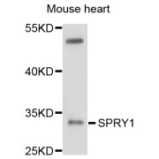 Western blot analysis of extracts of mouse heart, using SPRY1 antibody (abx126637) at 1/1000 dilution.