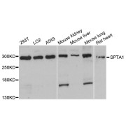 Western blot analysis of extracts of various cell lines, using SPTA1 antibody (abx126639) at 1:3000 dilution.