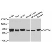 Western blot analysis of extracts of various cell lines, using SQSTM1 antibody (abx126645) at 1/1000 dilution.