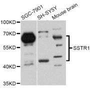 Western blot analysis of extracts of various cell lines, using SSTR1 Antibody (abx126654) at 1:3000 dilution.