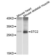 Western blot analysis of extracts of various cell lines, using STC2 antibody (abx126665) at 1/1000 dilution.