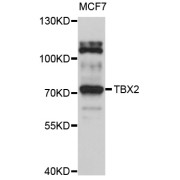 Western blot analysis of extracts of MCF-7 cells, using TBX2 antibody (abx126682) at 1/1000 dilution.