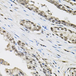 Transcription Elongation Factor B Subunit 1 (TCEB1) Antibody