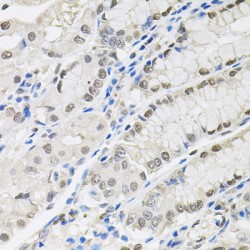 Transcription Elongation Factor B Subunit 1 (TCEB1) Antibody